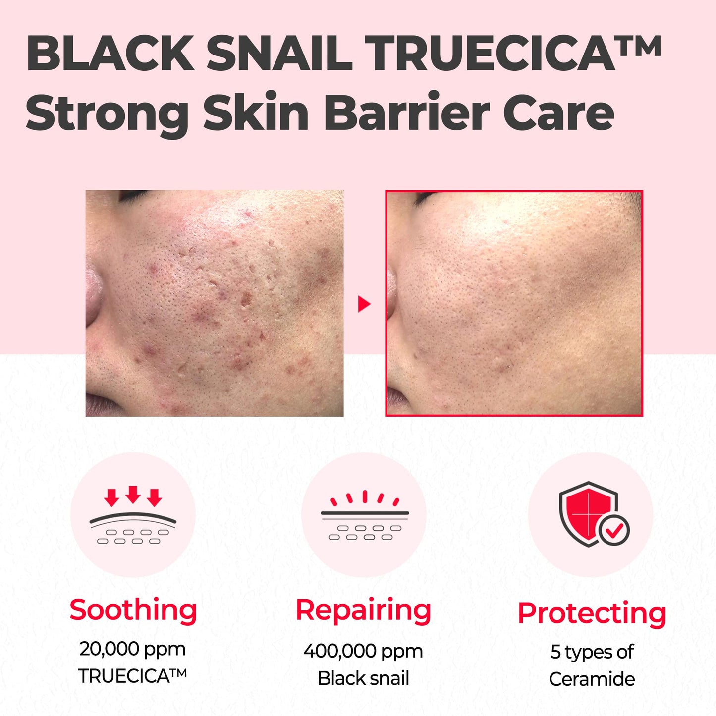 SOME BY MI - Crème miracle réparateur à l'escargot truecica , anti-rides et cicatrices 60g