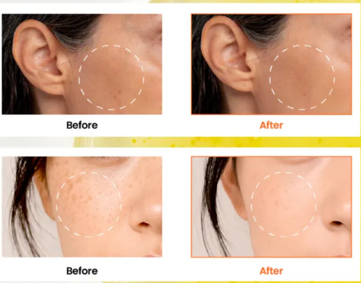 KSECRET - SEOUL 1988 Glow Serum : Niacinamide 15% + Yuja 30ml