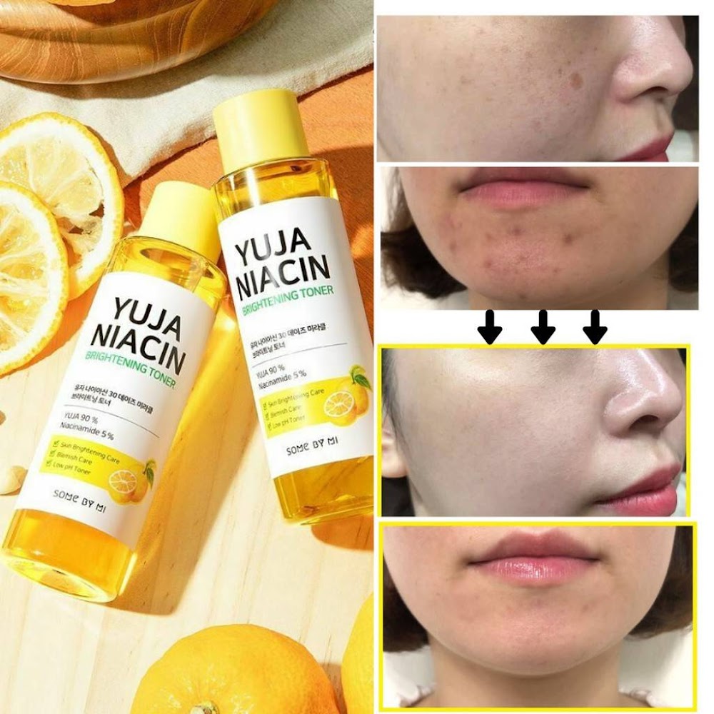 SOME BY MI - YUJA NIACIN toner éclaircissant anti-imperfections miracle 30 jours 150 ml
