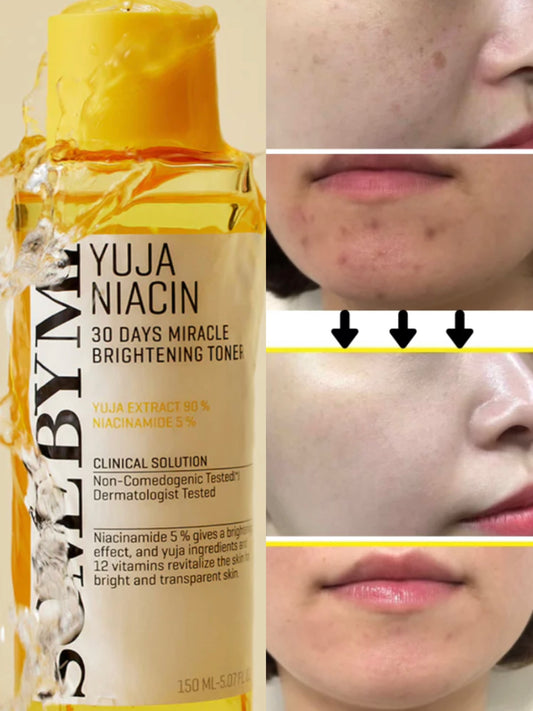 SOME BY MI 🇰🇷- Yuja Niacin 30 jours miracle Toner illuminateur anti-imperfections