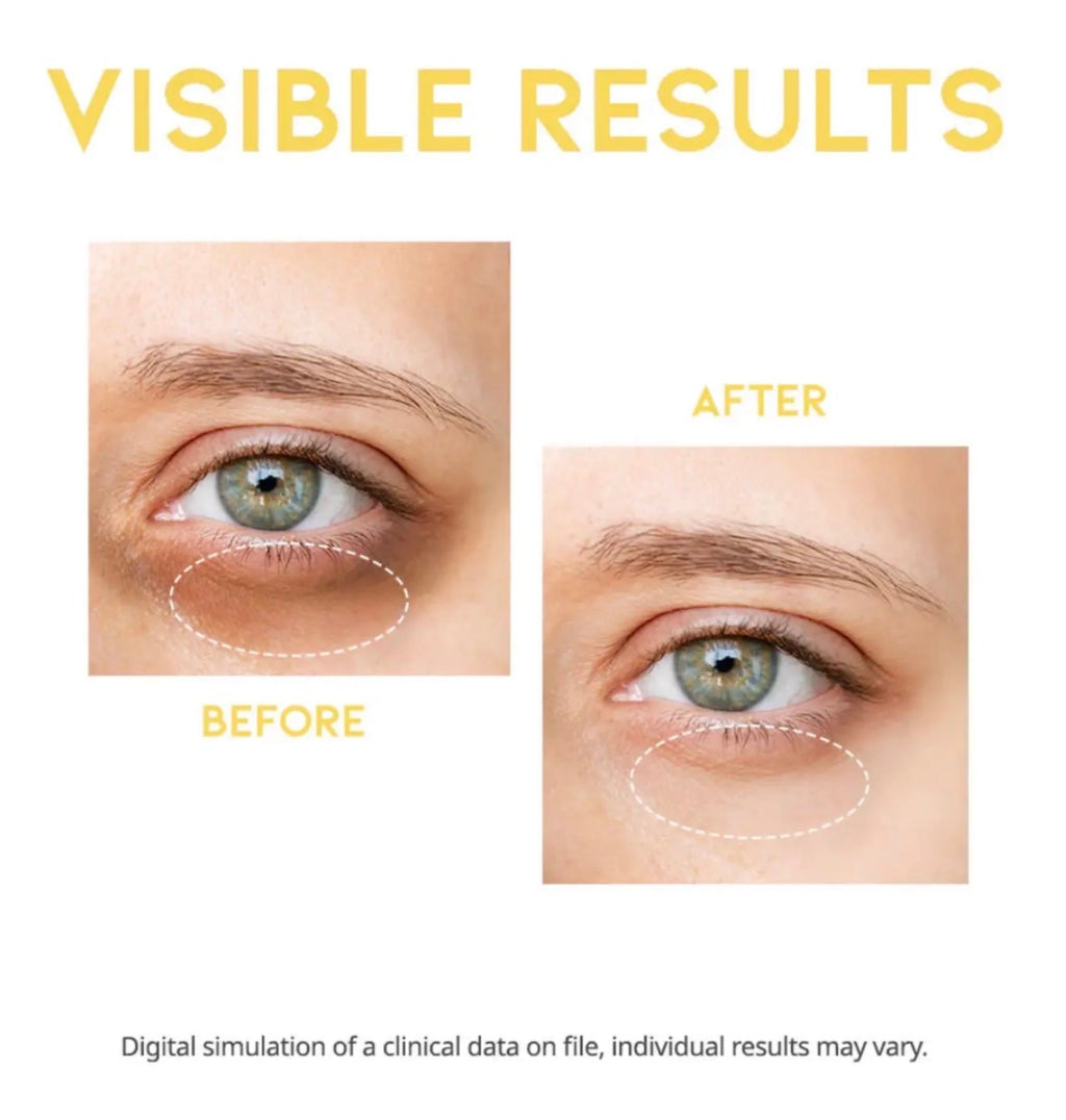 OOTD - Sérum pour les cernes