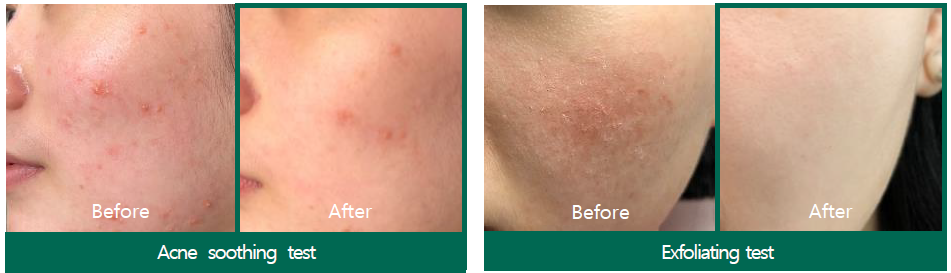 SOME BY MI - AHA BHA PHA Nettoyant miracle anti-acné 30 jours 100ml