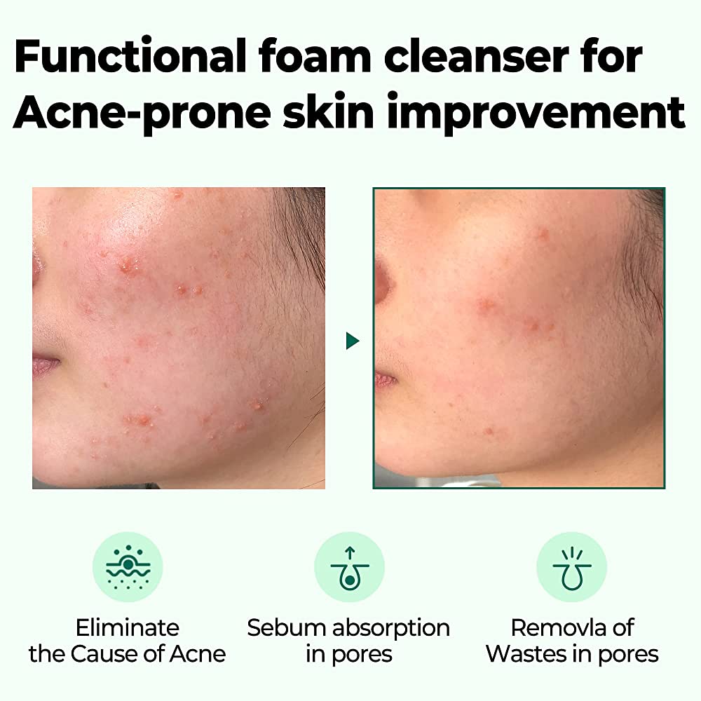 SOME BY MI - AHA BHA PHA Nettoyant miracle anti-acné 30 jours 100ml