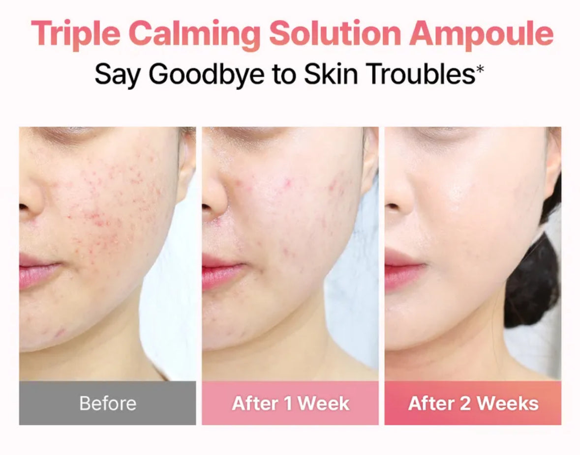 MOMMY CARE - Sérum apaisant à la feuille de fleur de lotus 50ml