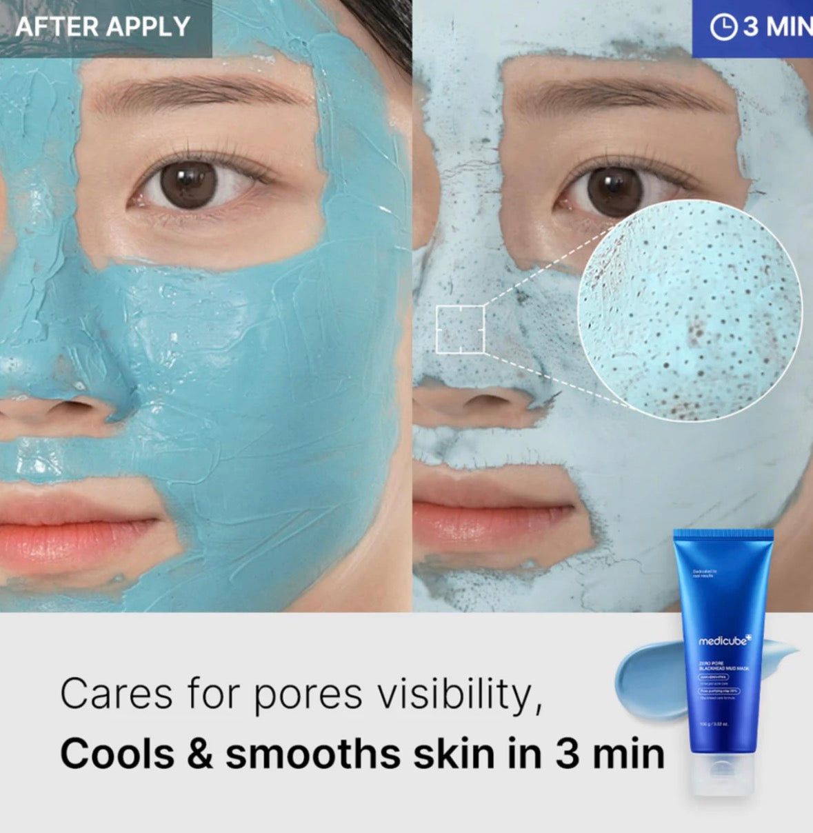 MEDICUBE Zero Pore : masque de boue correction pores dilatés et anti-points noirs 100g