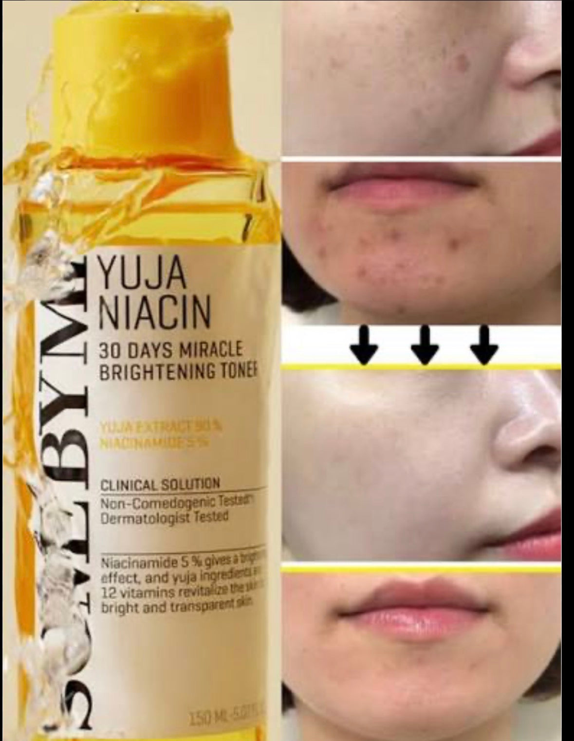 SOME BY MI 🇰🇷- Yuja Niacin 30 jours miracle Toner illuminateur anti-imperfections