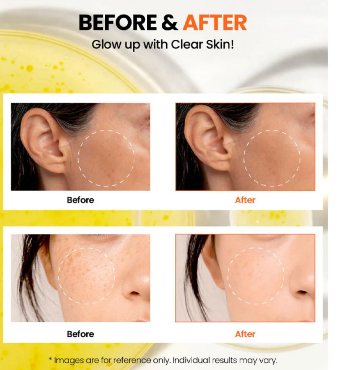 KSECRET - SEOUL 1988 Glow Serum : Niacinamide 15% + Yuja 30ml