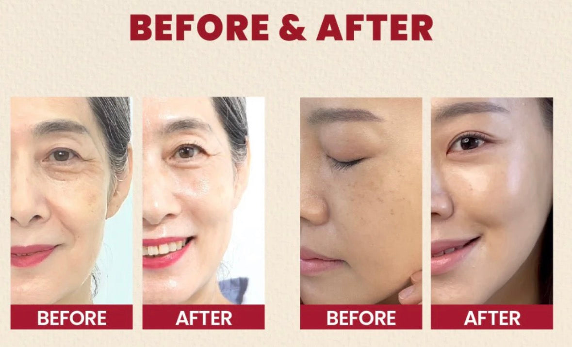KSECRET – Soin visage anti-âge au rétinal encapsulé et riz fermenté 50ml