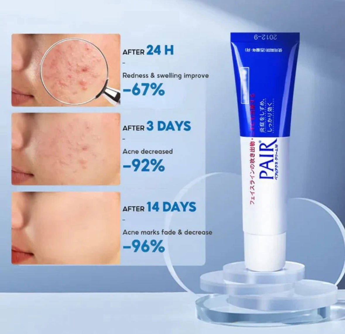 LION – Pair Acne Cream W, crème anti-acné 14g