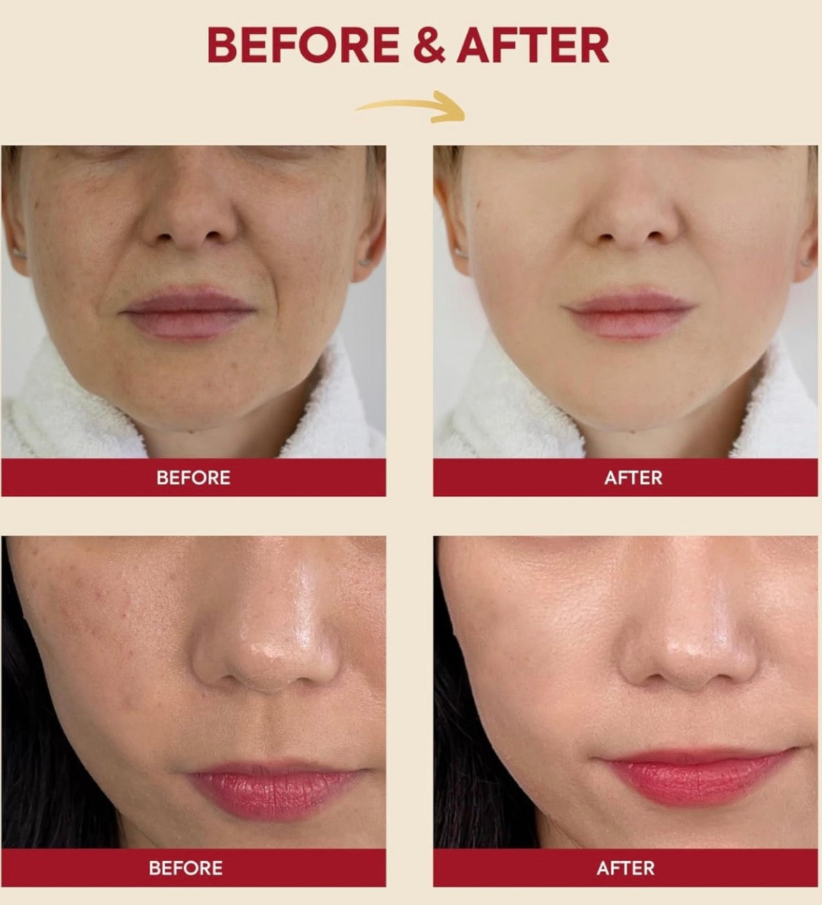 KSECRET - SEOUL 1988 Crème : Mucine d'Escargot 93 % + Riz 100ml